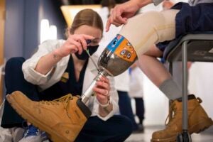 Female technician adjusting a prosthetic leg.