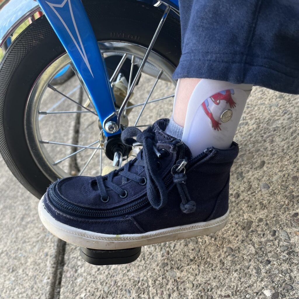 A child's foot wears a blue shoe and soft brace on his ankle as he pedals a tricycle.